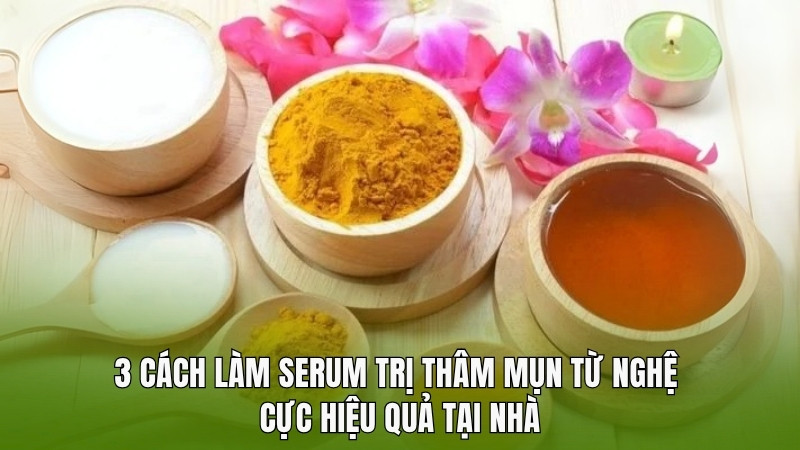 3 cách làm serum trị thâm mụn từ nghệ cực hiệu quả tại nhà