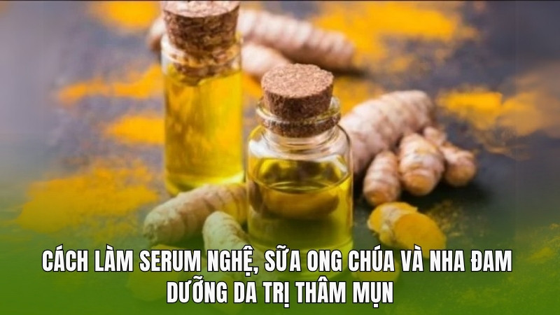 Cách làm serum trị thâm mụn từ nghệ, nha đam và sữa ong chúa