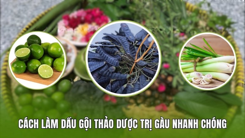 Cách làm dầu gội thảo dược trị gàu nhanh chóng