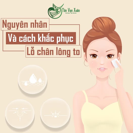 Kem tẩy lông